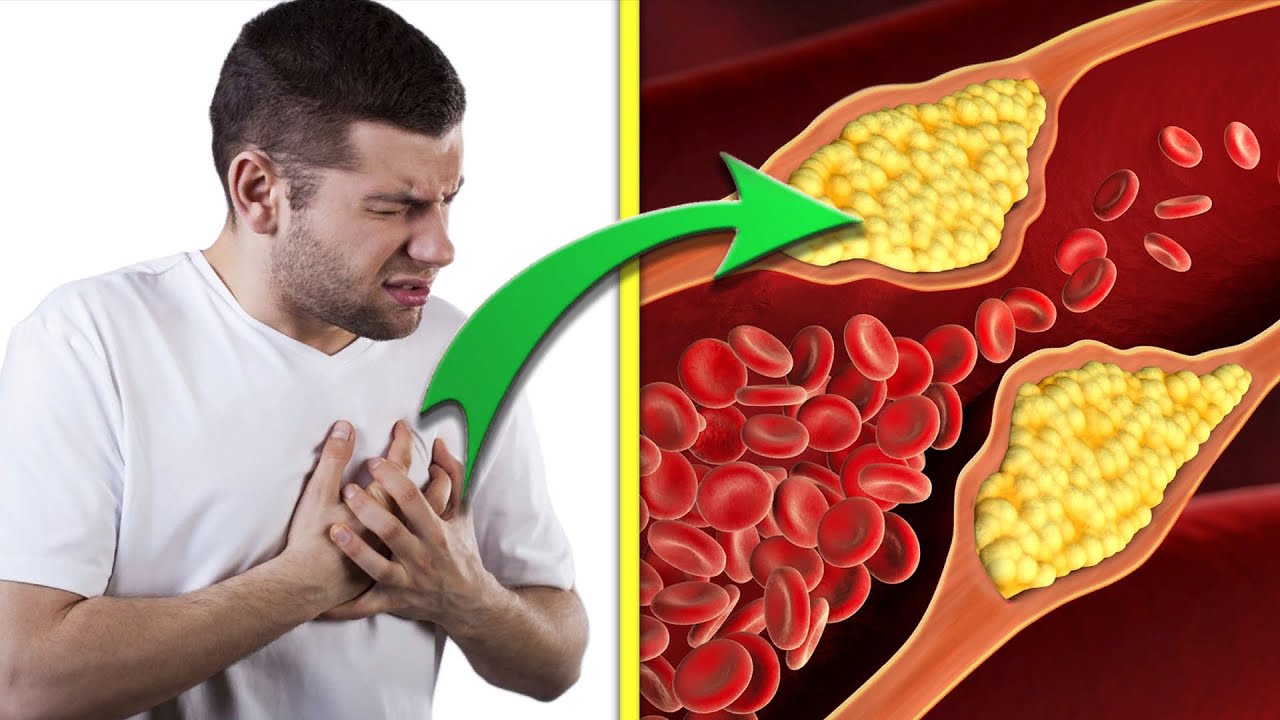 خواص زرشک برای کاهش کلسترول خون و حفظ سلامت قلب